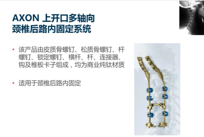  AXON上开口多轴向颈椎后路内固定系统