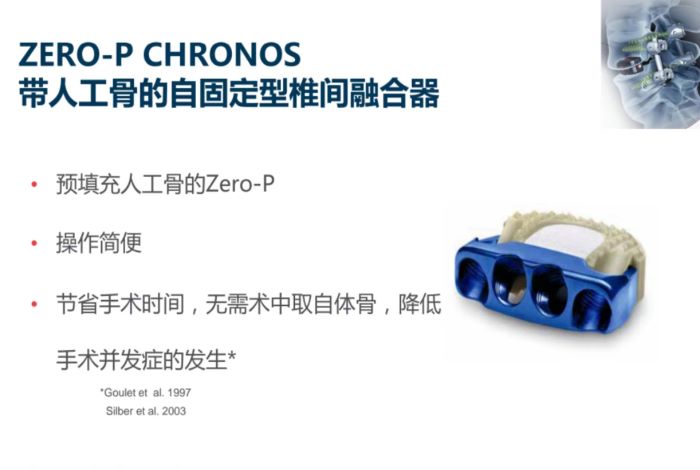  ZERO-P CHRONOS带人工骨的自固定型椎间融合器