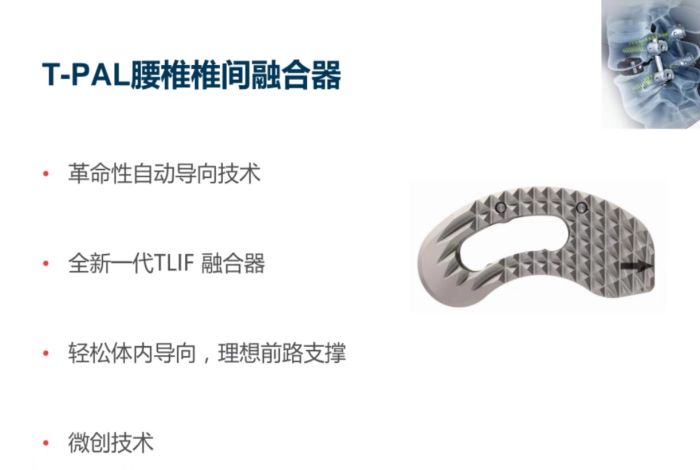  T-PAL腰椎椎间融合器